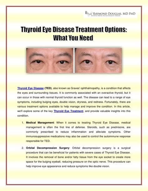 Ppt Thyroid Eye Disease Treatment Options What You Need Powerpoint