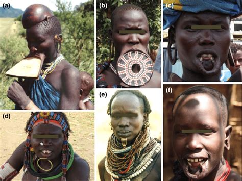 Lip Plates And Plugs In Africa A Surma Woman 21 Years With Wooden