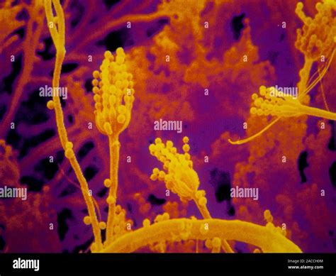 Fungus Coloured Scanning Electron Micrograph Of A Penicillium Sp