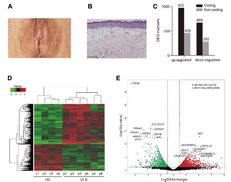 Figure From Transcriptome Profiling And Network Analysis Provide