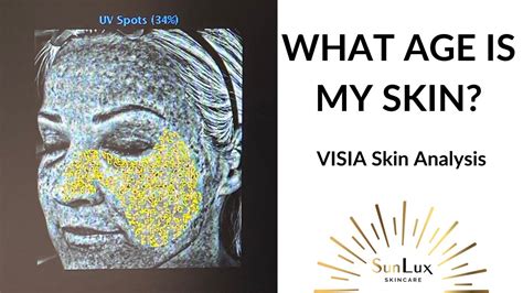 WHAT AGE IS MY SKIN VISIA SKIN ANALYSIS How Much SUN Damage Do I