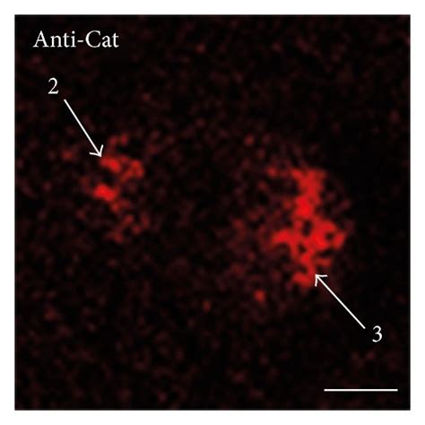 Double Labeling Immunofluorescence Demonstrating Colocalization Of Kp Download Scientific