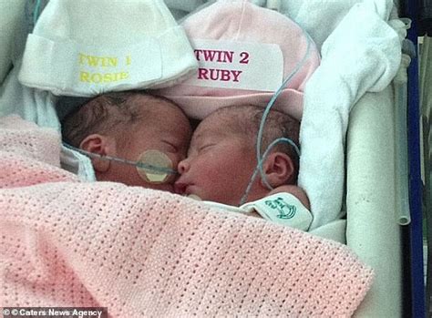 Mother Of Conjoined Twins Angela Formosa Tells Of Joy After Seeing