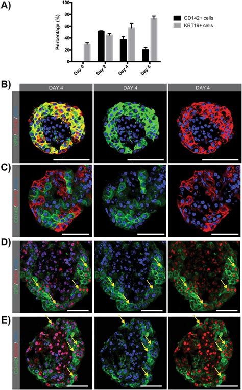 Acinar Derived Cells Coexpress Cd Gp Pdx And Sox A