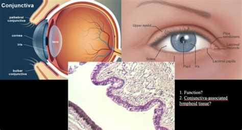 Diseases Of Conjunctiva Flashcards Quizlet