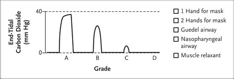 Management Of The Difficult Airway New England Journal Of Medicine