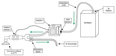 Moves® Slc™ In The Surgical Setting Anesthesia Integration With Madm