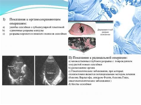 Операции на селезёнке презентация