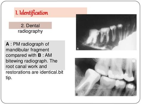 Presentation Forensic Radiology