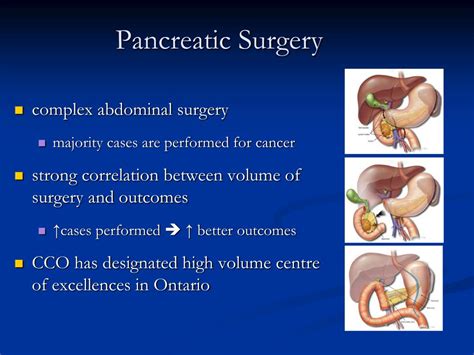 Ppt Hepato Pancreato Biliary Surgery Powerpoint Presentation Free