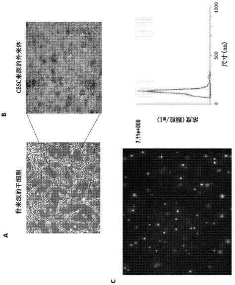 Augmenting Heart Function After Cardiac Injury With Exosomes Derived