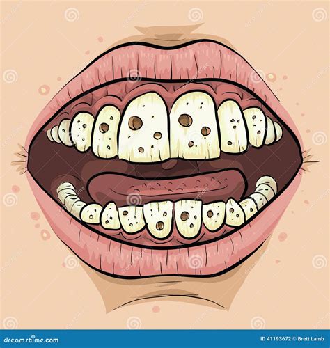 Cartoon Cavities Stock Illustration - Image: 41193672