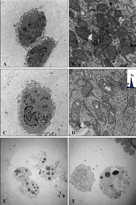 Transmission Electron Microscopy And Microanalysis A PC3 Prostate