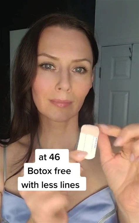 Im 46 And Reversed My Forehead Wrinkles Without Botox Forehead