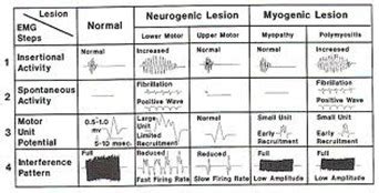 Dr. Grimm answers the question: What is an EMG test? - Best Pain Doctor NYC