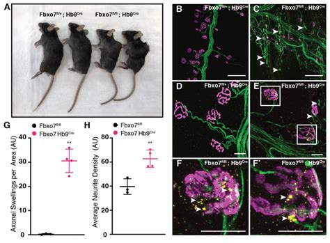 Motor Neuron Specific Inactivation Of Fbxo7 Resembles Loss Of Pi31