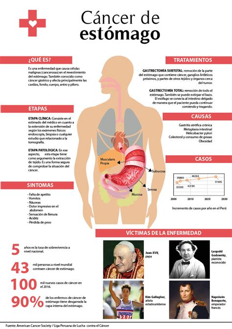 Cáncer De Estómago Muerte Lenta Punto Seguido Upc