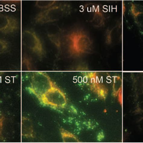 Fluorescence Photomicrographs Of ARPE 19 Cells Level Of ROS Generation