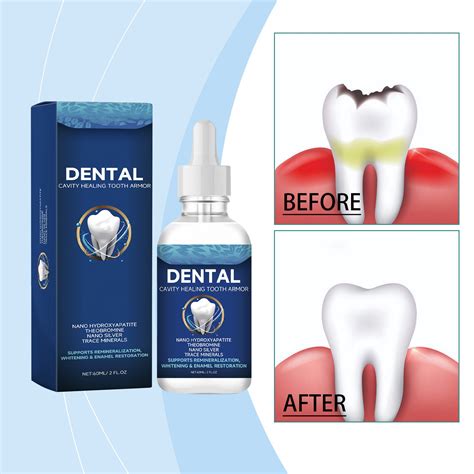 Donggwts Tooth Cleaning Care Solution To Tooth Decay Maintain Health Tooth Liquid 60ml Dentures