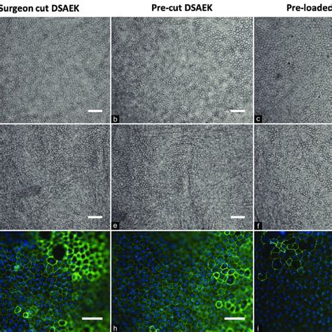 Corneal Endothelial Cell Density And Morphology Using Trypan Blue Download Scientific Diagram