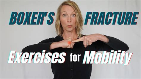 Top 6 Boxers Fracture Recovery Exercises For Hand And Finger Mobility