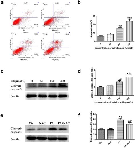 Palmitic Acid Induced Apoptosis In Podocytes Representative Images Of