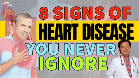 8 Signs Of Heart Disease You Never Ignore By Doctor Willie Ong