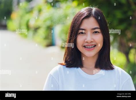 Asian Girl With Braces Telegraph