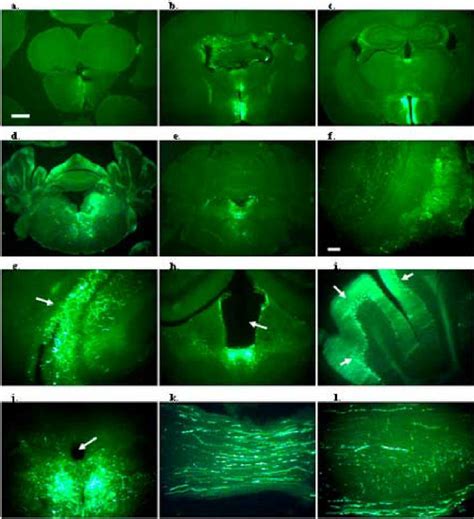 AAV Mediated GFP Expression In Mouse Brain After Intracisternal