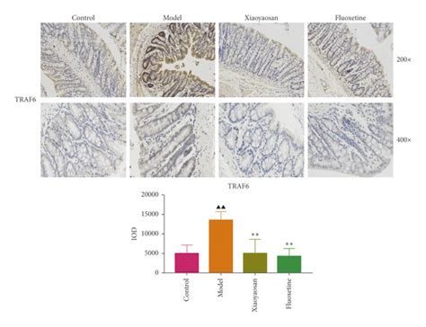 The Effect Of Xiaoyaosan On The Immunohistochemistry Of TLR4 MyD88