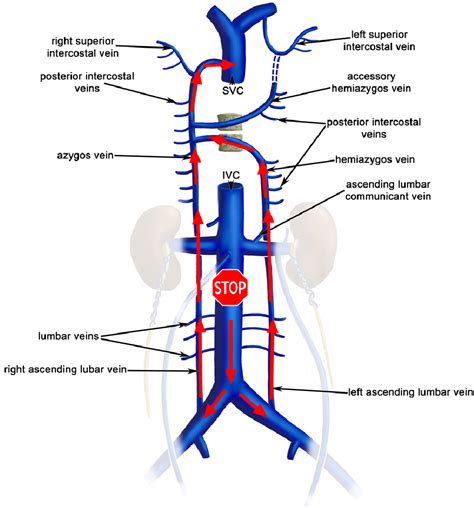 Vena Cava Diagram