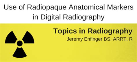 The Importance Of Radiopaque Markers In Digital X Ray