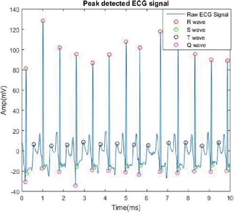 Magnitude And Phase Response Of FFT Figure 8 Detection Of Peaks In An