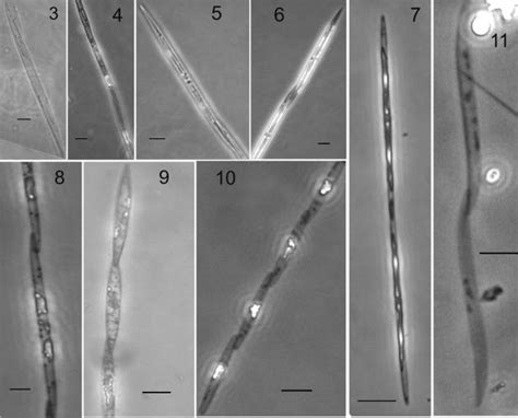 Monthly Mean Abundance Of Phytoplankton Diatoms And Pseudo Nitzschia