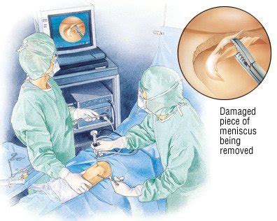 Arthroscopic Surgery Guide