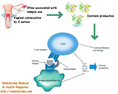 Pathogenesis Of Toxic Shock Syndrome Tss Medchrome