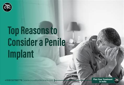 Top 5 Reasons To Consider A Penile Implant