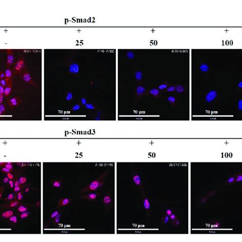 Gastrodin Inhibited The Expressions Of Smooth Muscle Actin Sma