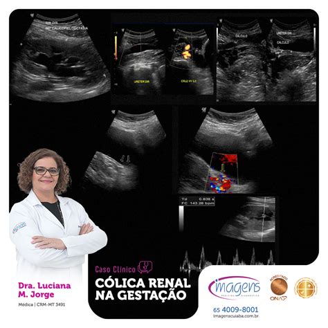 Onde É A Colica De Gravidez - Colica Renal na Gestação | Dica do Especialista - Imagens - Medicina ...