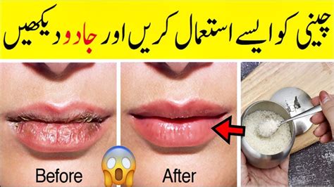 How To Get Rid Of Dark And Dry Lips Lip Care Balm At Home Lip Care