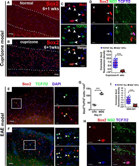 Sox2 Is Expressed In Adult Opcs And Upregulated In Tcf7l2 Expressing