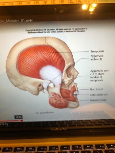 Muscles Of Mastication Flashcards Quizlet