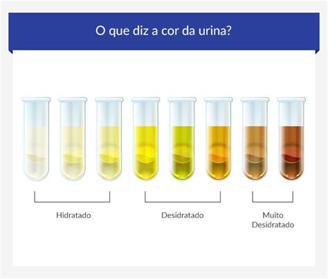 Veja O Que Revela As Cores Da Urina Cor Da Urina Urina Marrom Images