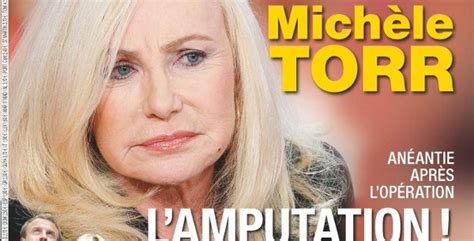 Michèle Torr brise le silence sur l amputation de son mari