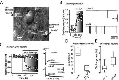 Activation Of Cholinergic Interneurons Reduces KCNQ Channel Current In