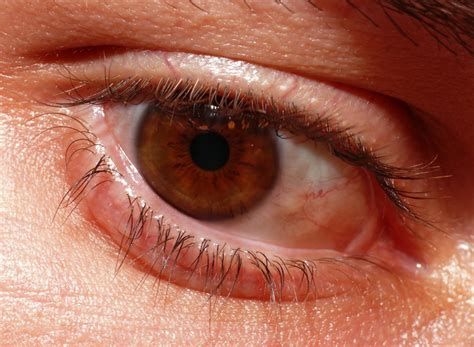 Causes Of Eyelid Twitching In Adults Brightkindl