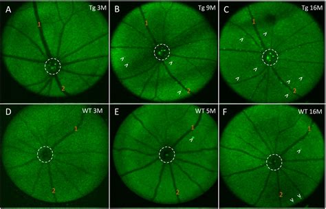 Frontiers In Vivo Retinal Fluorescence Imaging With Curcumin In An