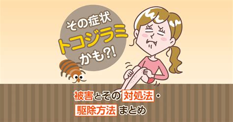 トコジラミに刺されたときの症状は強いかゆみが特徴！ダニとの違いと対処法 害虫駆除110番