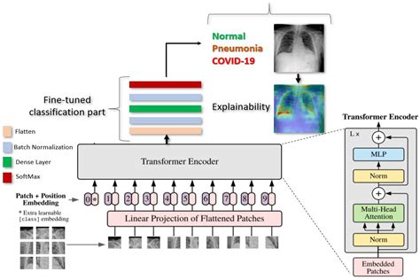 JCM Free Full Text Explainable Vision Transformers And Radiomics