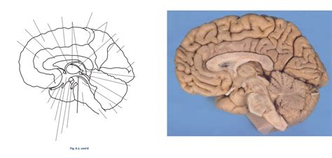 Sagittal Cross Section For Exam Diagram Quizlet